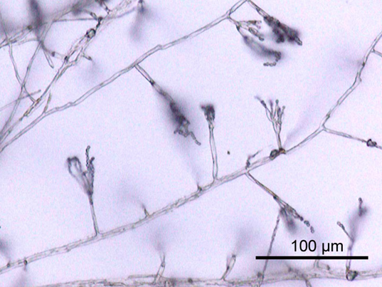 Tamaño del hongo Penicillium sp.